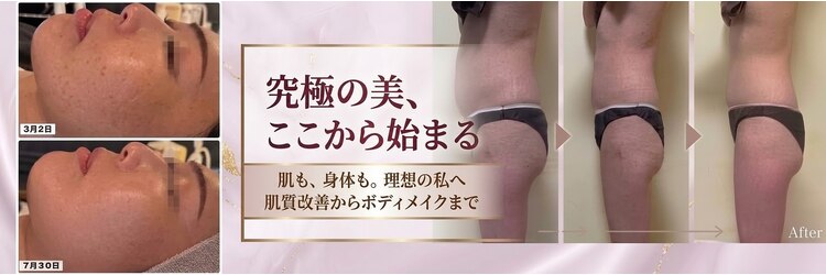エステティック リオン(Rion)のサロンヘッダー
