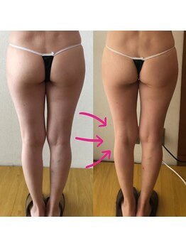 ピアリーノ(Pialino)/