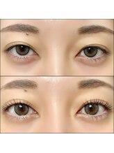 レジアント(Rediant)/パリジェンヌラッシュリフト