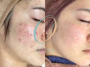 オリス 京都店(oliss)