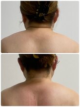 エヌラボ(N.LABO)/深層筋膜リンパ×最新痩身機器