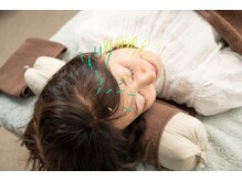 北梅田美容鍼灸院/【大阪/梅田】美容鍼週灸