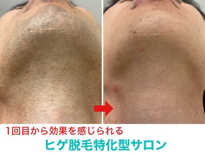 ミスターアンクール 鹿児島(Mr.uncoeur)の写真
