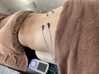 土浦すずらん鍼灸接骨院/鍼灸施術