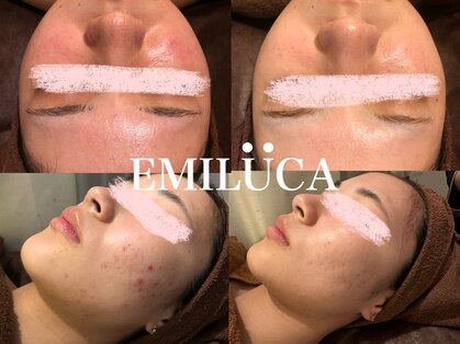 エミルカ 北谷店(EMILUCA)の写真