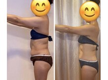 エルバードの雰囲気（50代のお腹周りも☆骨盤から変わって浮き輪が乗らない♪）
