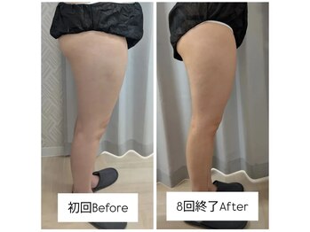 クレール 小山店(CLAIR)/【痩身(3ステップ)】