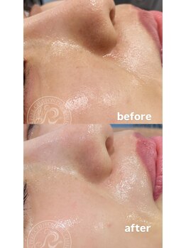 セレネ(SELENE)/くすみ、乾燥、シワのお悩み