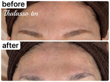 アール(R)/【タラソトリートメント】