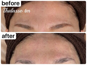 アール(R)/【タラソトリートメント】