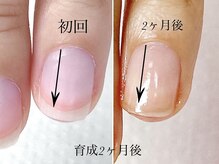 トゥインクリーネイルサロン(Twinkly Nail Salon)/【地爪育成】1回お試し