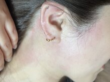 ワクシングハニー(waxing HONEY)/うなじも&みあげWAX脱毛