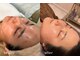 サロンムーン 赤坂(salon moon)の写真/【肌トラブル改善 /完全オーダーメイド施術】結果重視×1人ひとりに寄り添った本気の根本肌質改善ケア◎