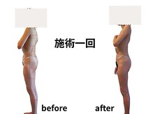 ココモドルの雰囲気（神経アプローチをする事で、即効性と持続性があります。）