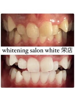 ホワイト 名古屋栄店(WHITE)/