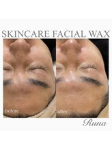 ルーナ(Runa)/■メンズOK【半顔WAX】45分¥6600