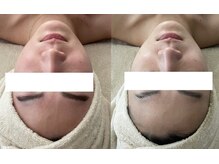 モーヴ(MAUVE)/次世代ハーブ陶肌トリートメント