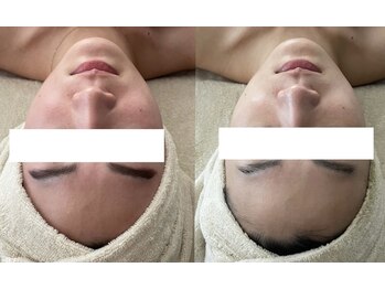 モーヴ(MAUVE)/次世代ハーブ陶肌トリートメント