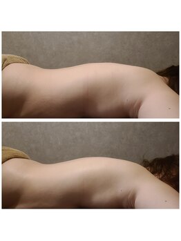 ウォーマル(warmaL)/ホットストーン＋アロマタッチ