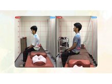 船橋はりきゅう整骨院/鍼/肩こり/腰痛/整体/マッサージ