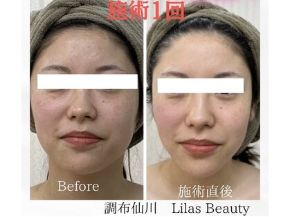 リラビューティー(Lilas Beauty)の写真