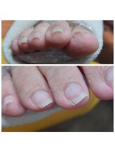 爪切り屋 足楽/【サロンケア】