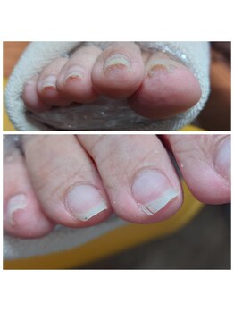 【サロンケア】