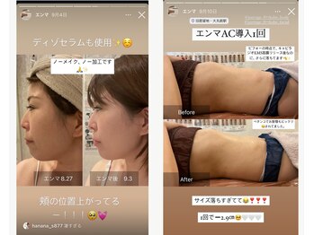 パルタージュ 三宮(Partage)/フェイシャル＆痩身