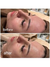 アムールドゥ 麻布十番(Amour deux)/贅沢フルコース4点セット