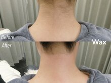 アイロンボーイ(IRONBOY)/うなじ＋首筋WAX ｜脱毛ワックス