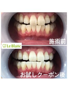 ルブラン 奈良店(Le Blanc)/初回で