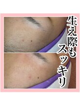 エクラーレ(Eclale)/マリムーブフェイシャルワックス