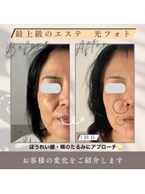 ママニエ(ma maniere)/究極のエイジングケア光フォト