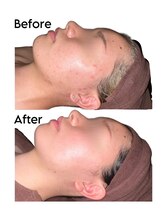 ビューティースタイリング 自由が丘店(beauty styling)/【本気の肌質改善】