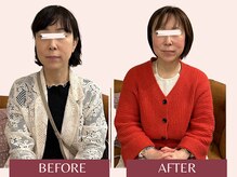 アンリール(Anrire)/【板橋/フェイシャルエステ】