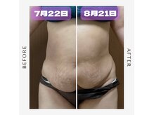 痩身 脱毛専門サロン 椿の雰囲気（１ヶ月ビュッフェ！劇的変化！食事制限なしです。）