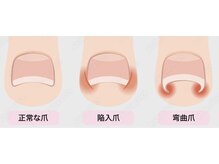 ネイルサロン チェリッシュ(Nailsalon Cherish)/ご自身のお爪はどれですか？
