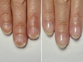 オリネイル 岐阜駅店(Oli nail)の写真/岐阜市初出店！大人気★自爪育成専門サロンがNEWOPEN！【10名限定】オープンキャンペーン実施！
