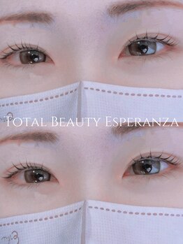 エスペランサ(Esperanza)/