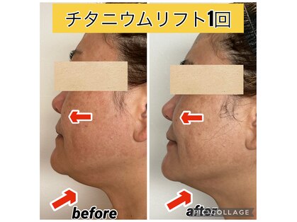 ルース(LUCE)の写真