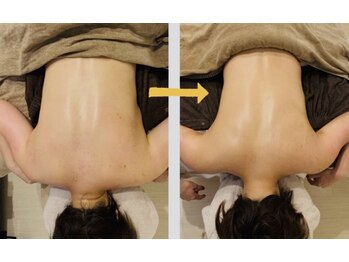 オリエンタル ルボワール(oriental Revoir)/カッピングドレナージュ