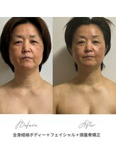 フェアリーゴッドマザー(Fairy Godmother)/たった１回の施術で大変身！！！