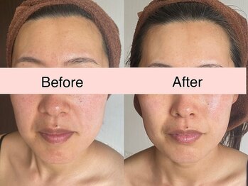 サクラ 伊勢原店(SAKURA)/若々しさは【お顔から】