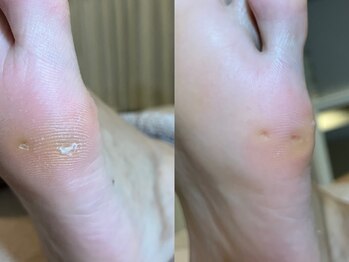 メグムサロン(Megumu Salon)/空ルート整体/足つぼ/マッサージ