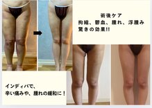 スリーピングビューティー(Sleeping Beauty)