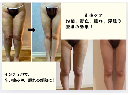 スリーピングビューティー(Sleeping Beauty)の写真