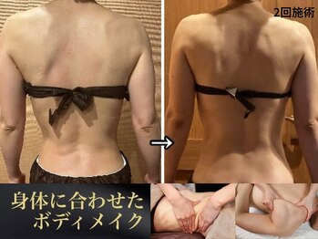 アクアリジェ/1回のボディラインの変化に驚愕!