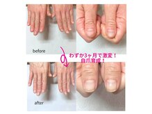 ポノアカラー(Pono a Color)の雰囲気（大人気！地爪をきれいな縦爪に育成する【自爪育成コース】！）