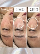 ナナラ(Nanala)/お客様の症例