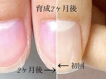 トゥインクリーネイルサロン(Twinkly Nail Salon)/【地爪育成】1回お試し